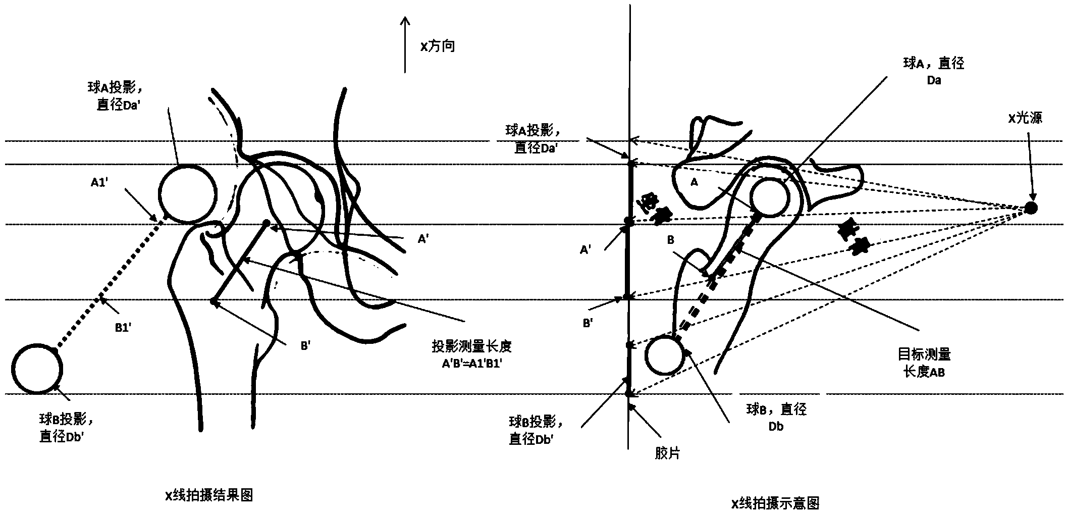 Correcting device and method for X-ray image digital measurement