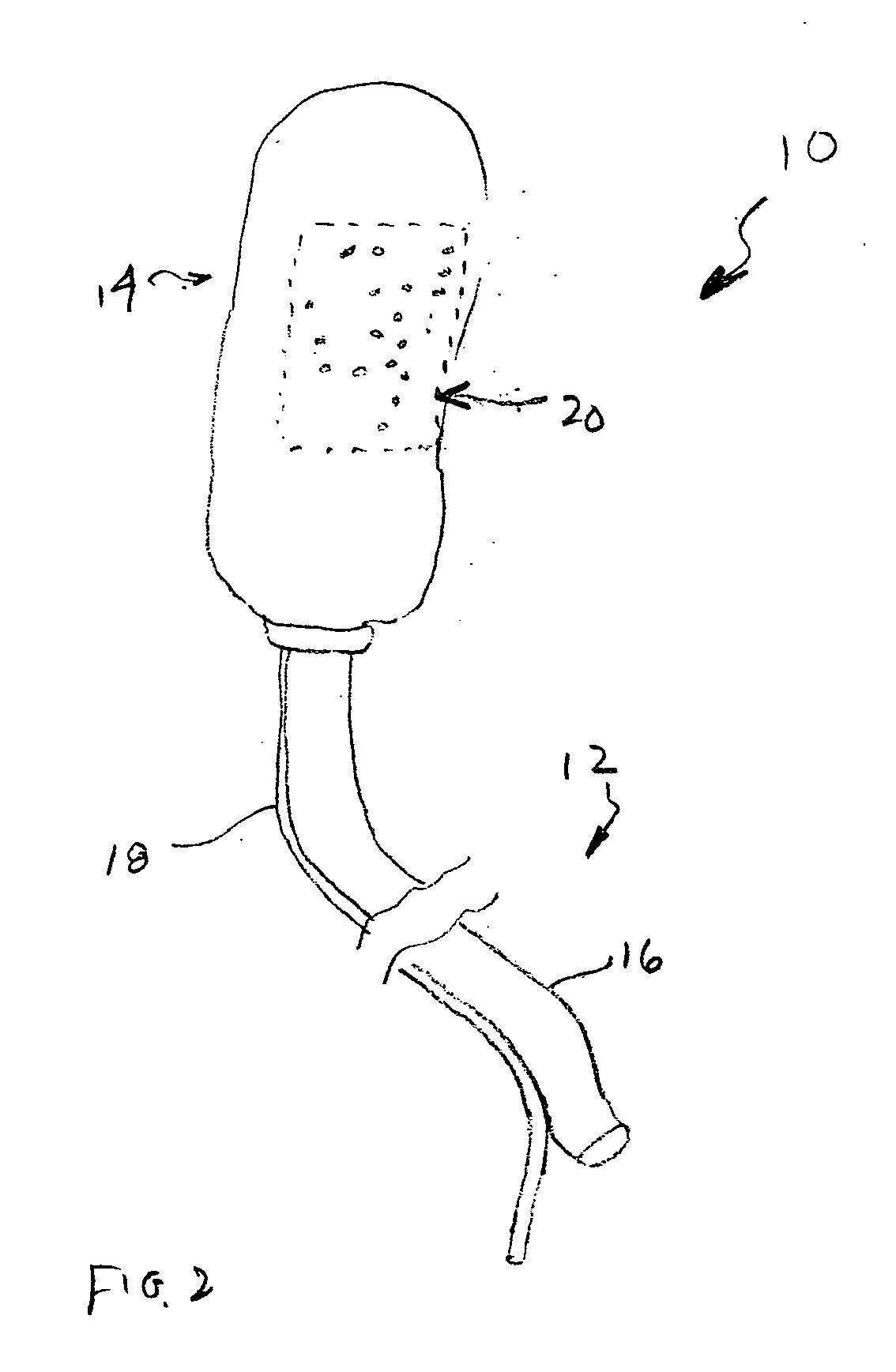 Devices and methods for promoting the formation of blood clots in esophageal varices