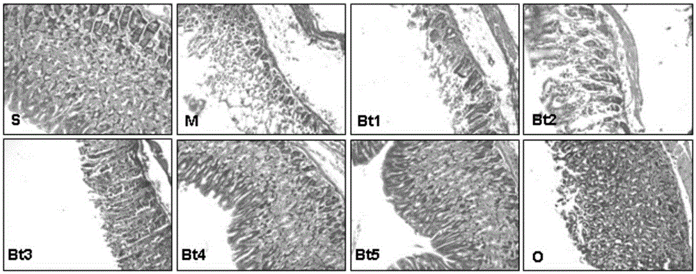 Application of butyric acid and salts thereof in preparation of medicine for treating or preventing gastric ulcer