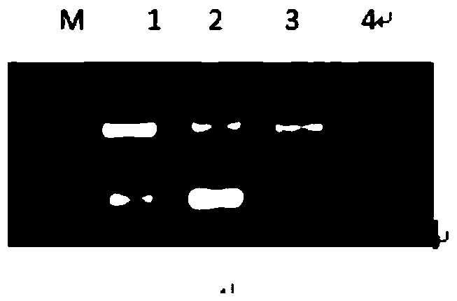 Recombinant adeno-associated virus-nadh dehydrogenase subunit 4 gene full-length and agent for the treatment of leber hereditary optic neuropathy