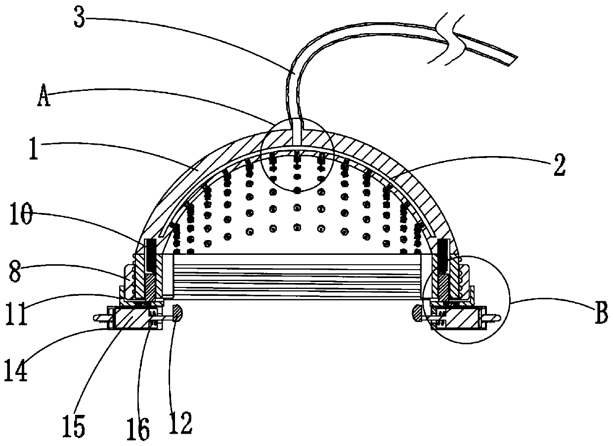 Migraine treatment device in neurology