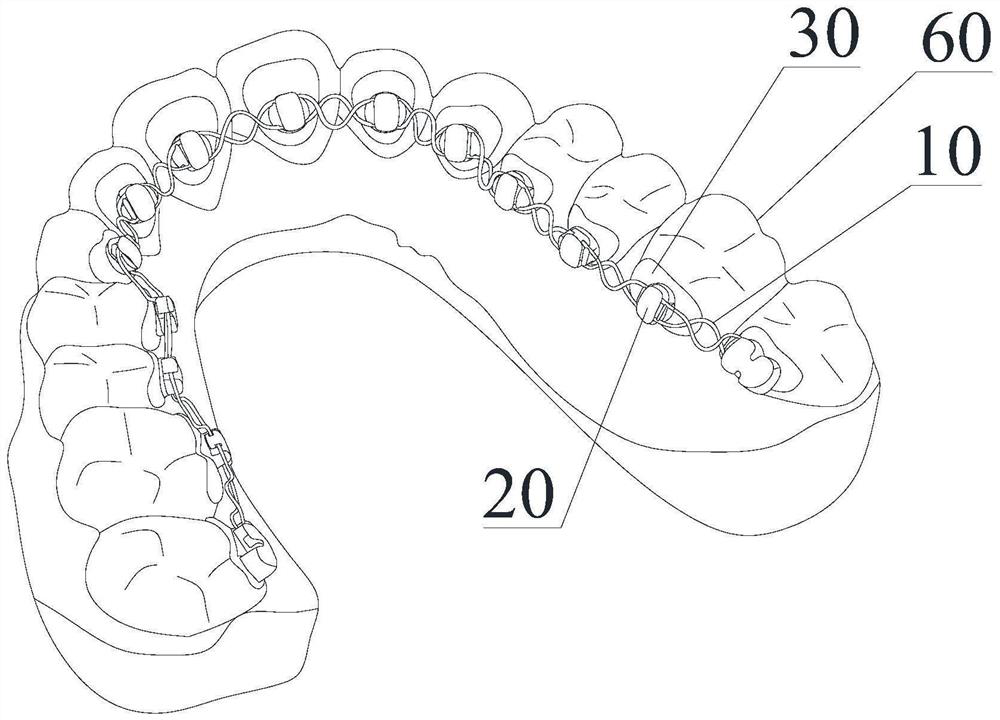 Removable and wearable appliance and manufacturing method thereof