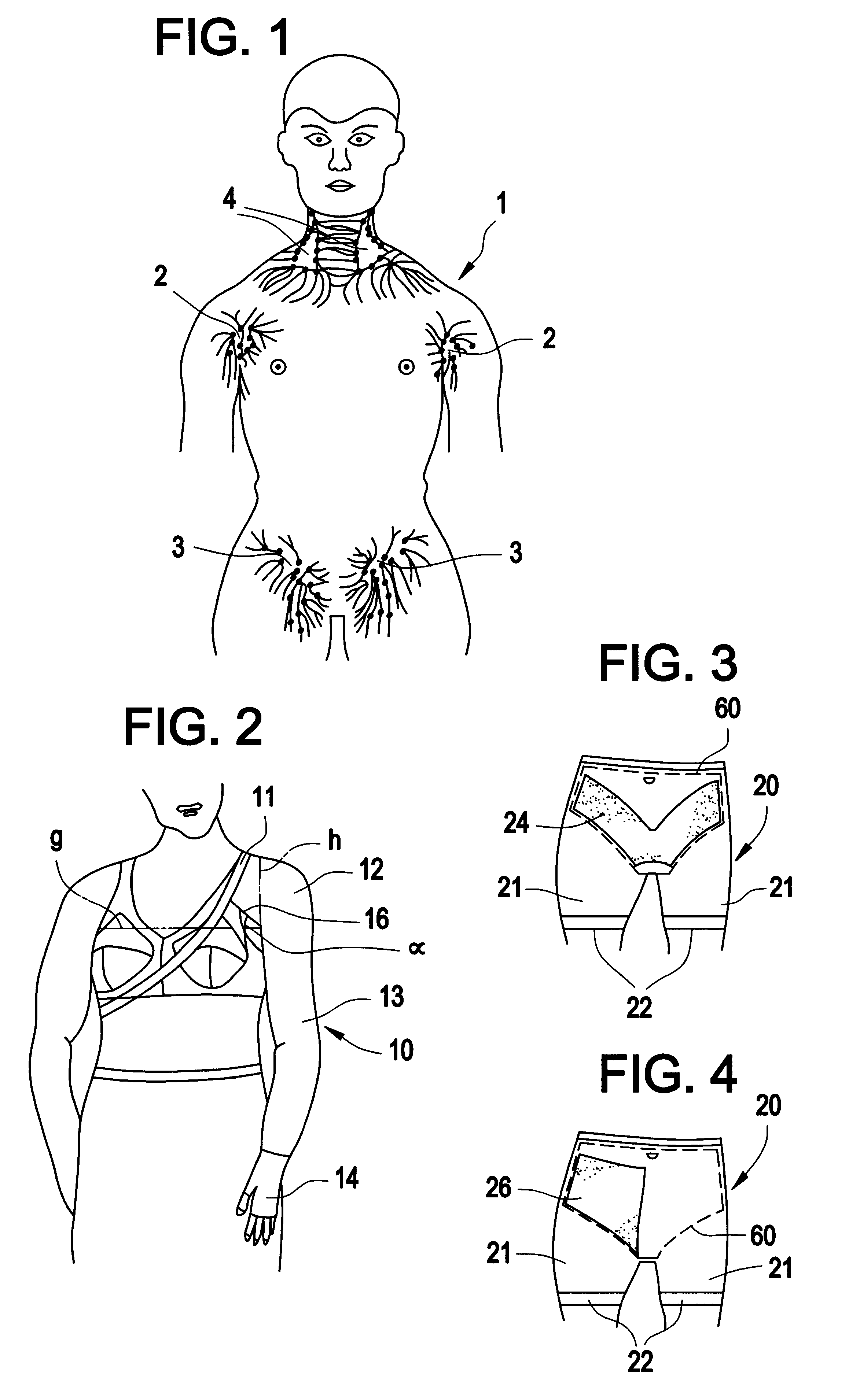 Compression hose, compression pants and accompanying compression pad