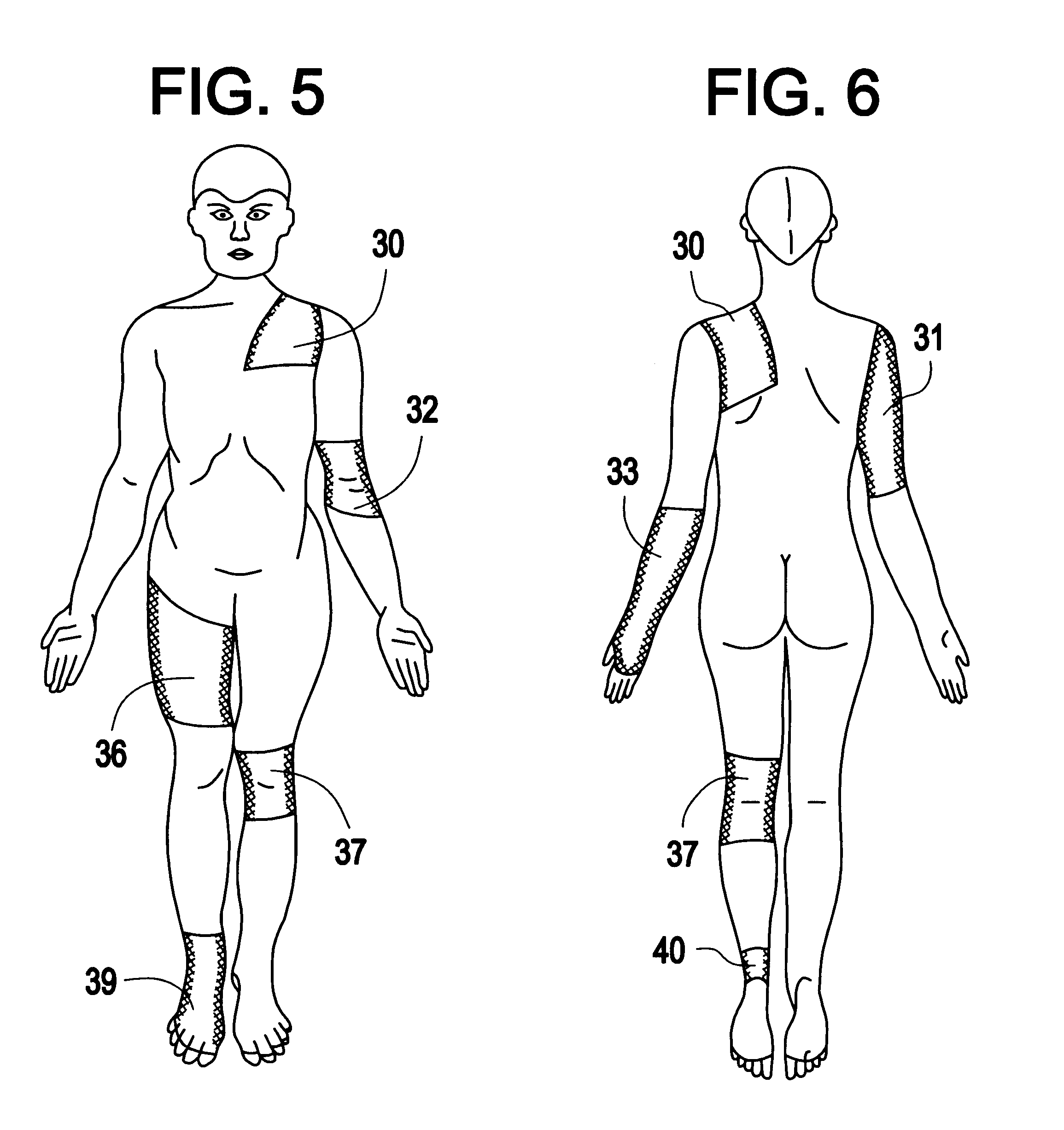 Compression hose, compression pants and accompanying compression pad