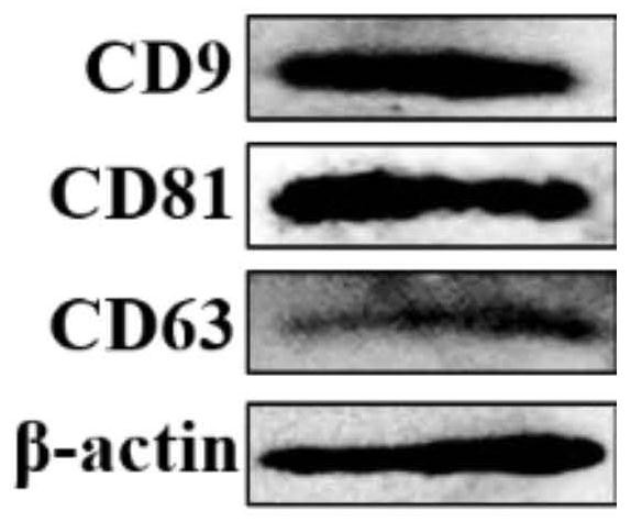 Application of stem cell exosome in preparation of drug for resisting colitis deterioration