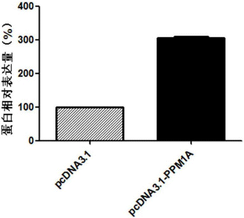 Molecular marker related to gastric adenocarcinoma metastasis