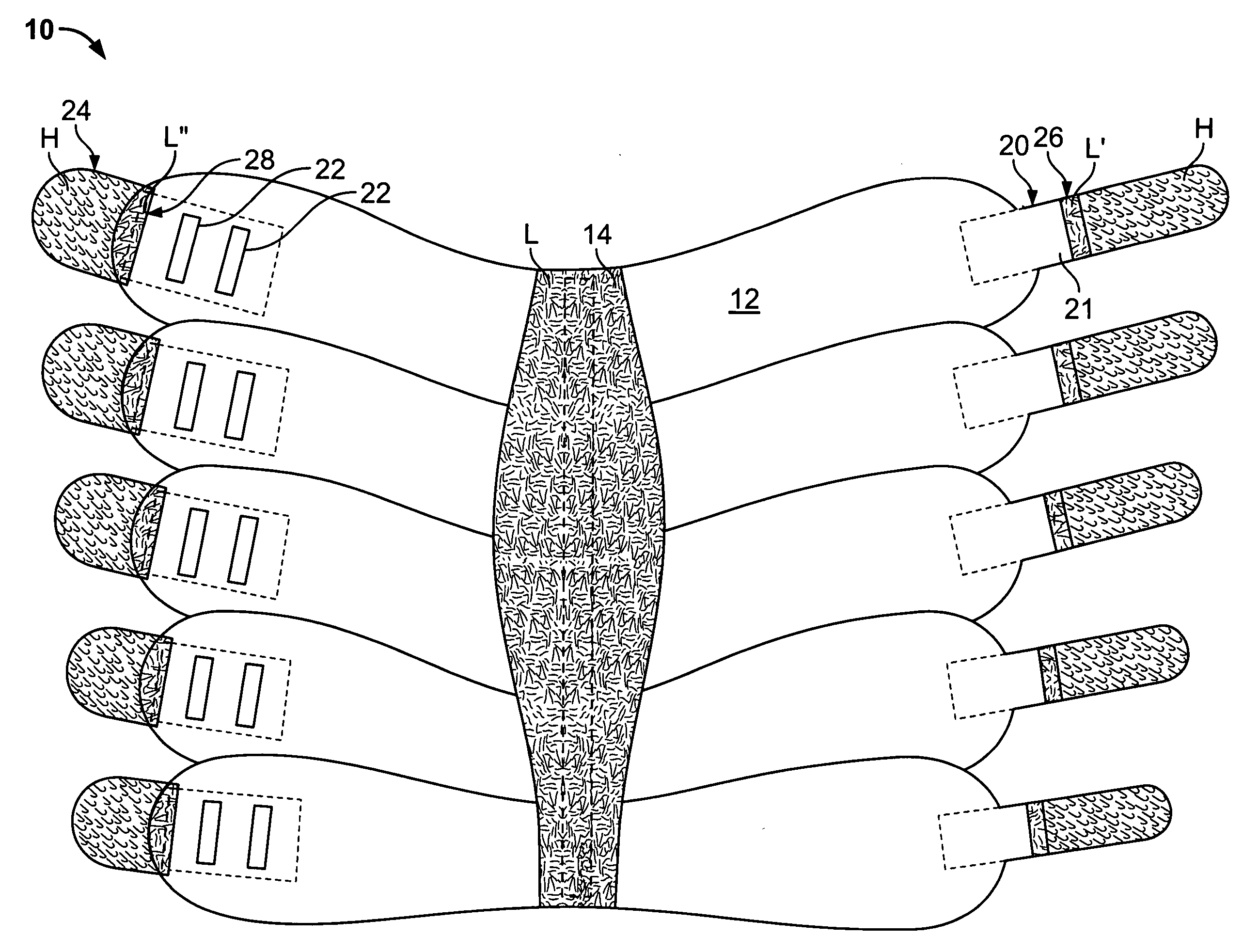 Therapeutic device having auxiliary strap holding positions