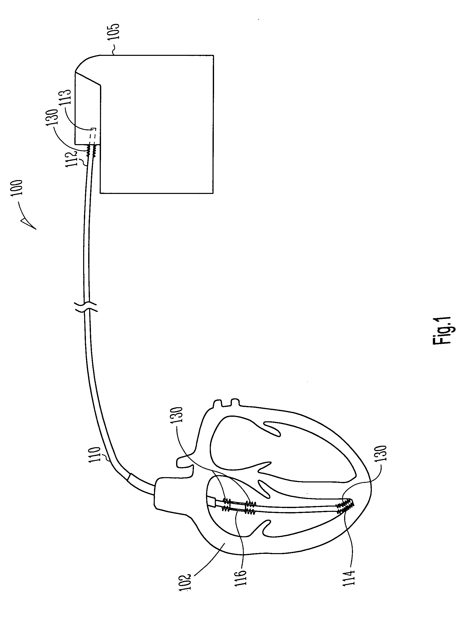 Lead assembly with flexible portions and method therefor