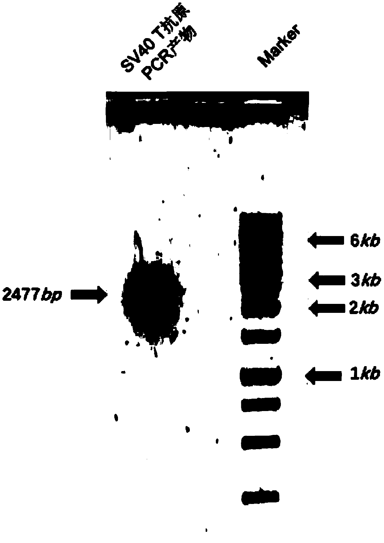 Method for obtaining immortalized cell strain through transfection by lentiviral vector mediated SV40 T antigen