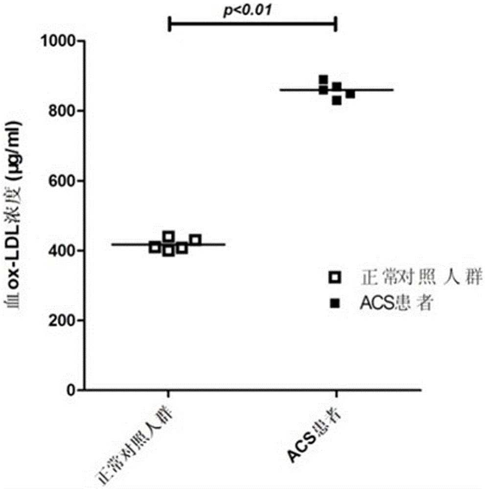 A liquid chip kit for acute coronary syndrome and its preparation method