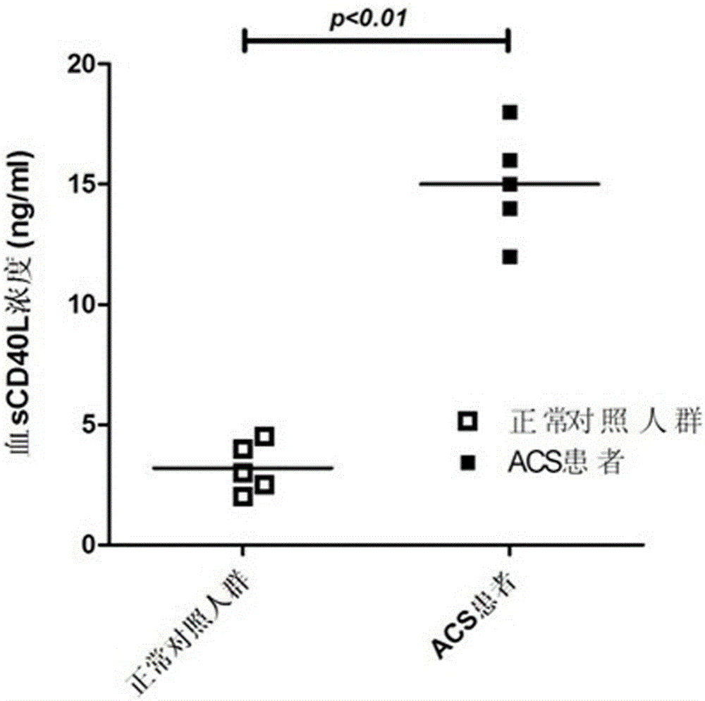 A liquid chip kit for acute coronary syndrome and its preparation method