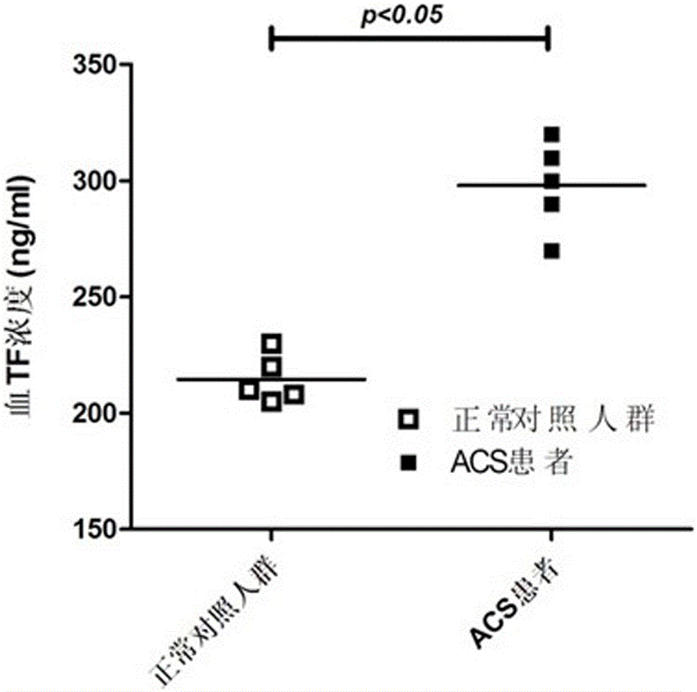 A liquid chip kit for acute coronary syndrome and its preparation method