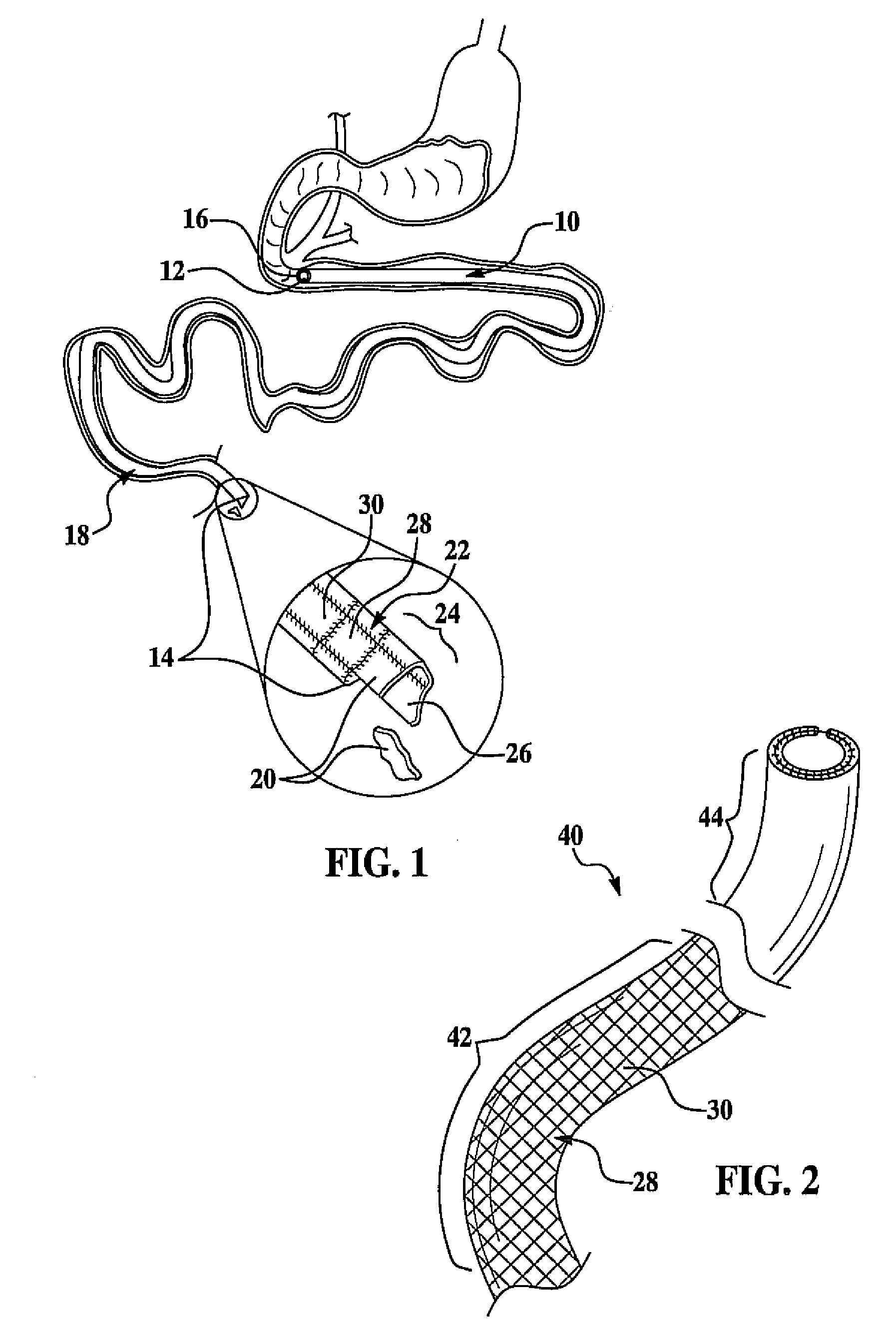 Disintegrating digestive tract barrier