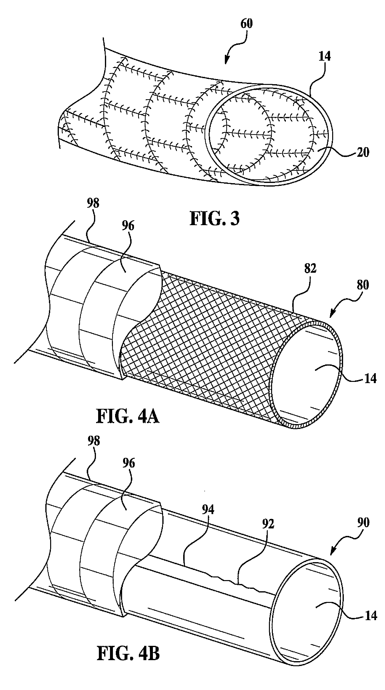 Disintegrating digestive tract barrier