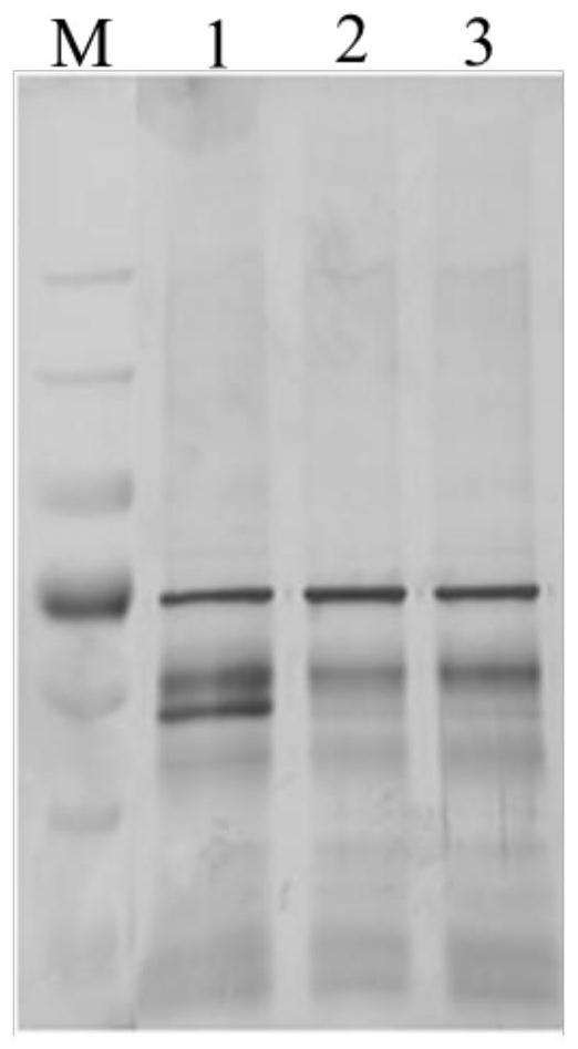 Application of anti-camk2a autoantibody reagents in preparation of kits for diagnosing neurological symptoms related diseases