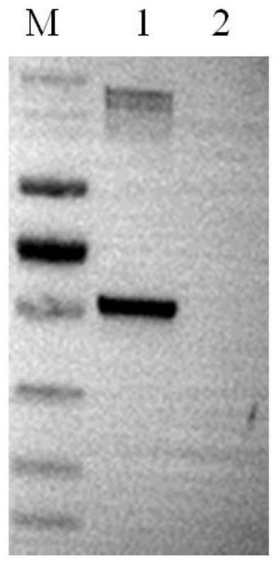 Application of anti-camk2a autoantibody reagents in preparation of kits for diagnosing neurological symptoms related diseases