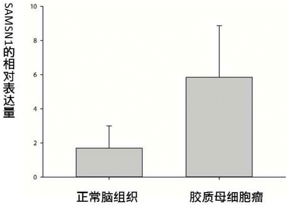 Application of SAMSN1 protein in preparation of glioblastoma prognosis evaluation reagent or kit