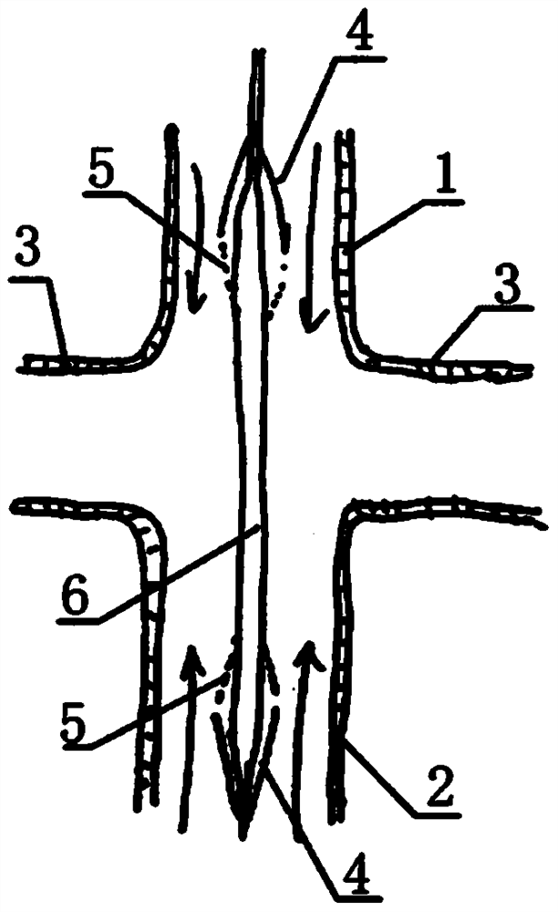 A new assistive device for the treatment of fontan circulatory failure