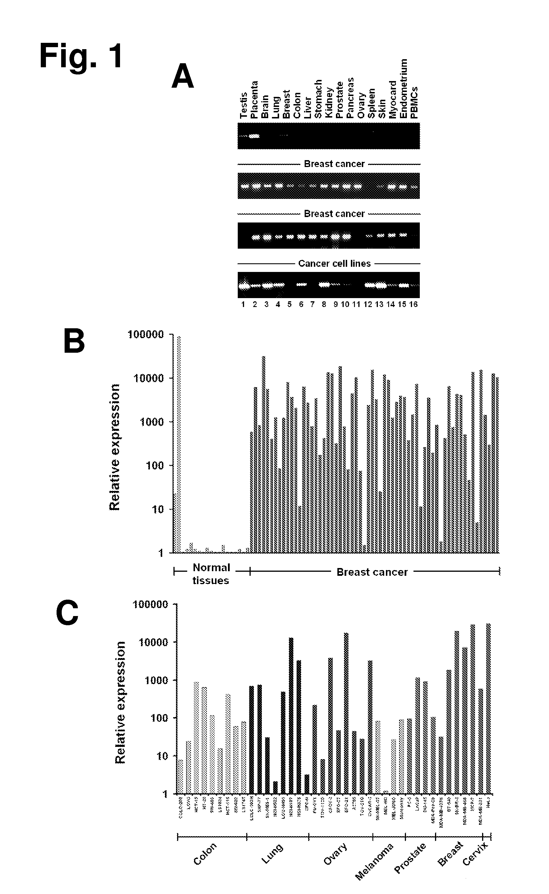 Monoclonal antibodies for treatment of cancer