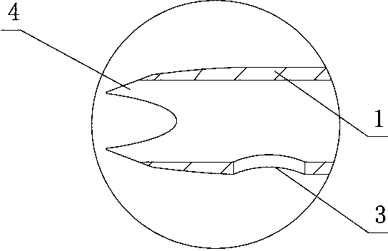 Type-II bone cement injection device