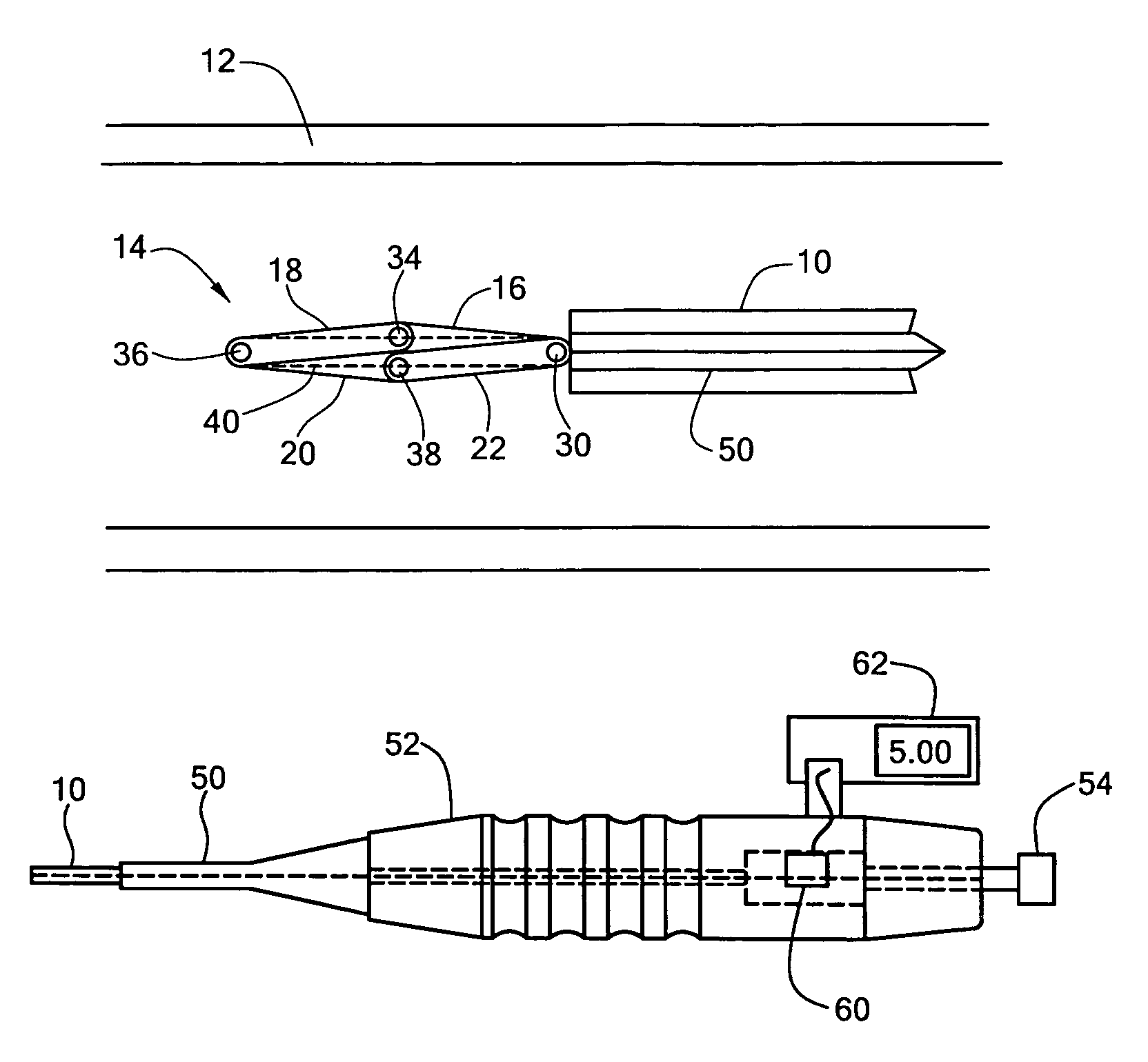 Replacement heart valve sizing device