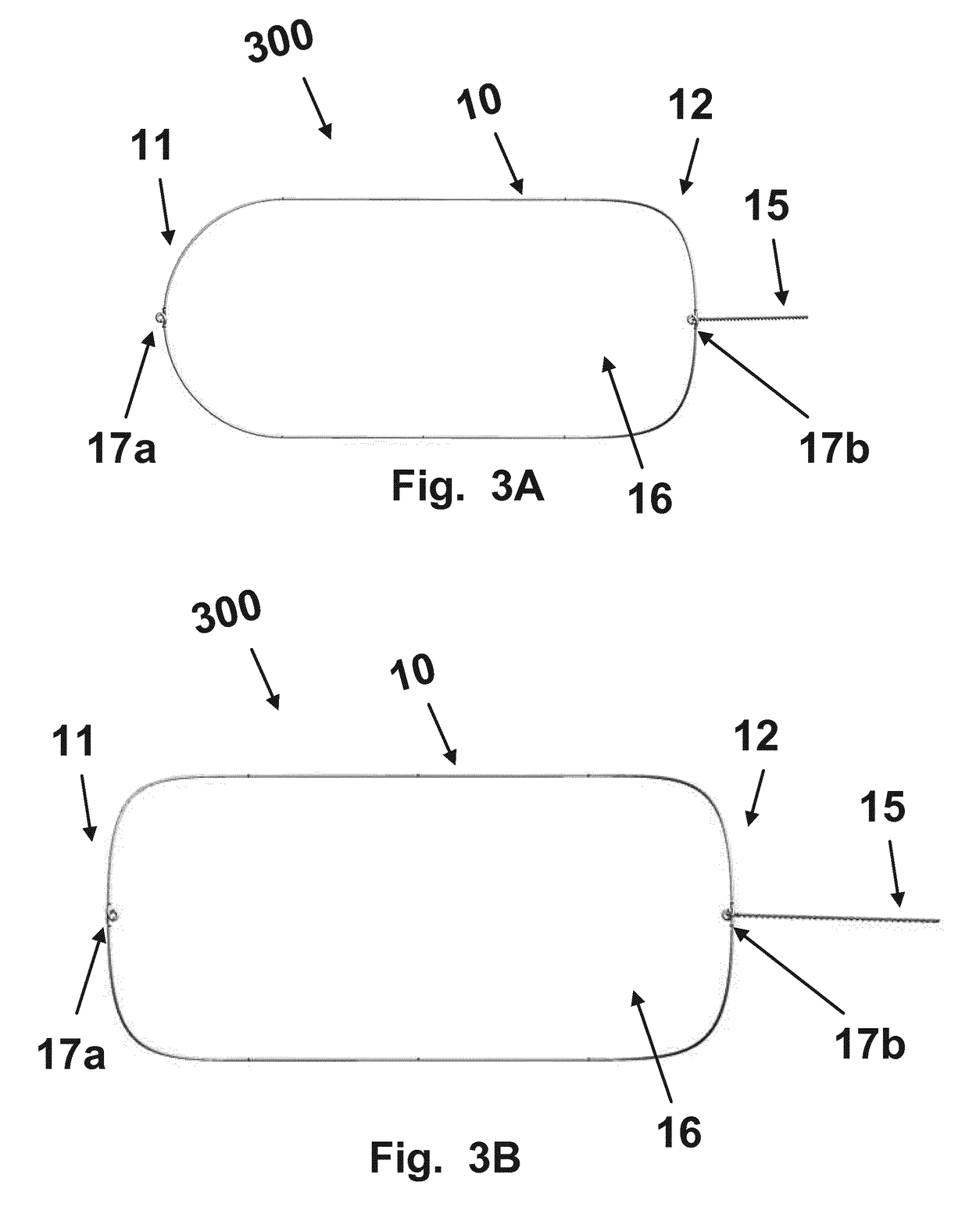 Intra-Aortic Device