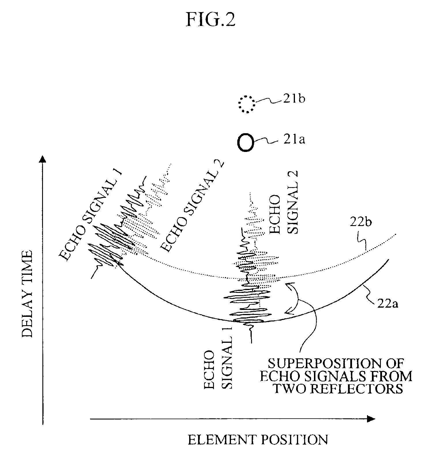 Ultrasonic imaging apparatus and method