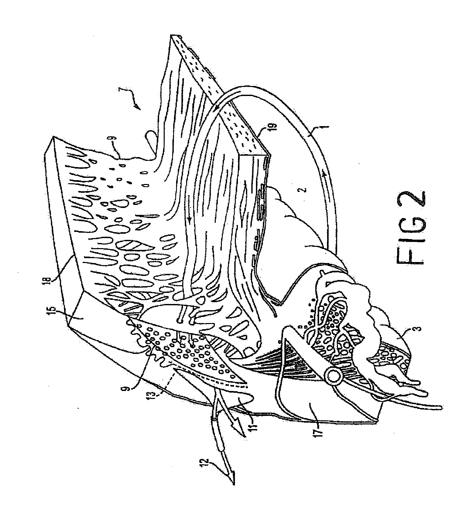 Methods and apparatuses for the treatment of glaucoma using visible and infrared ultrashort laser pulses