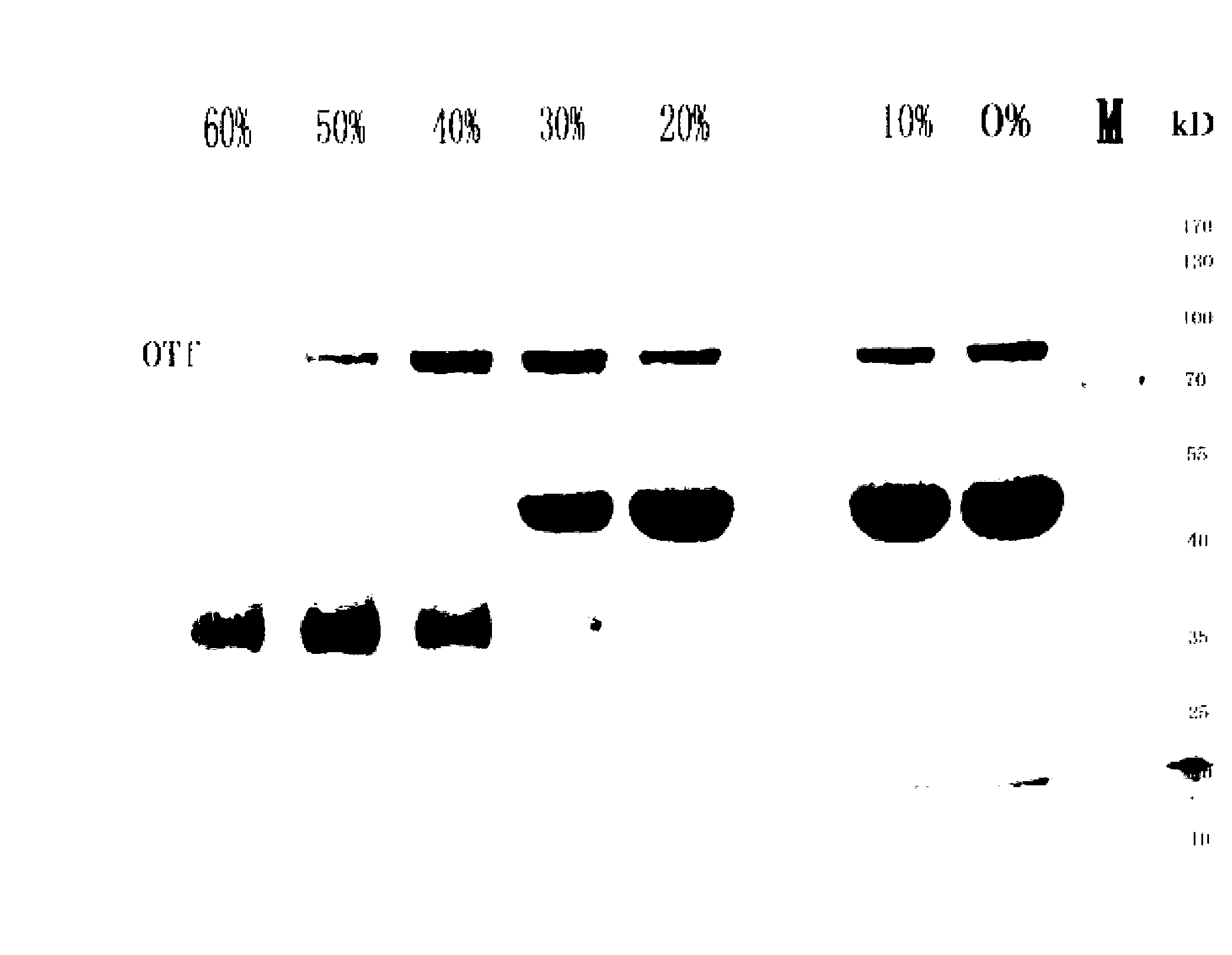 Method for extracting ovotransferrin from egg white