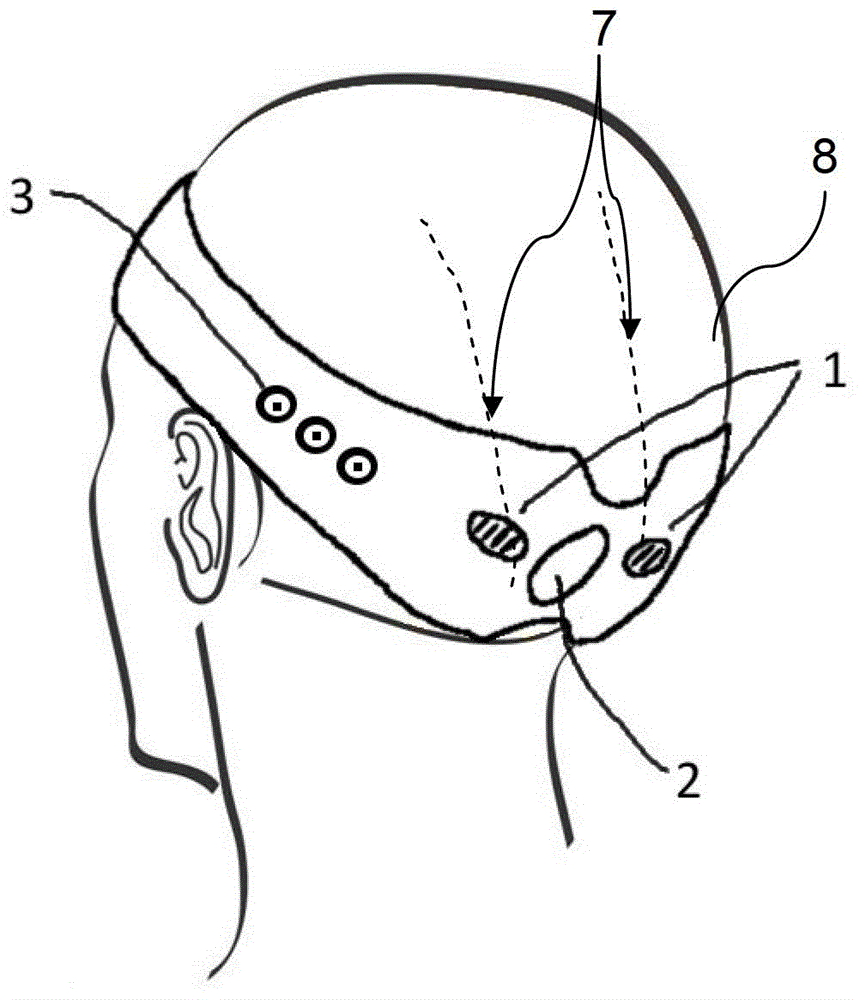 Headband for External Occipital Nerve Stimulation