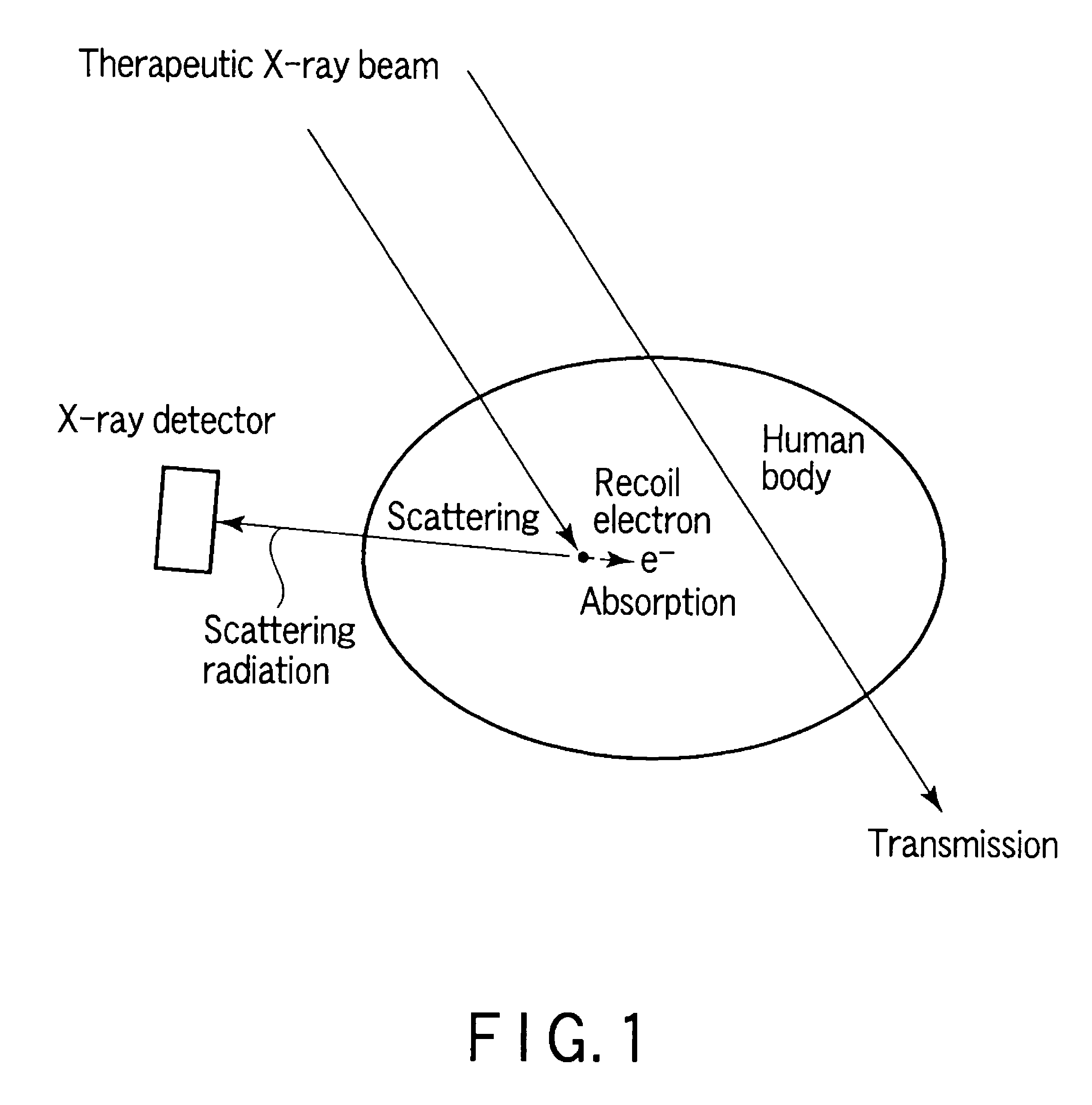 Radiotherapy support apparatus