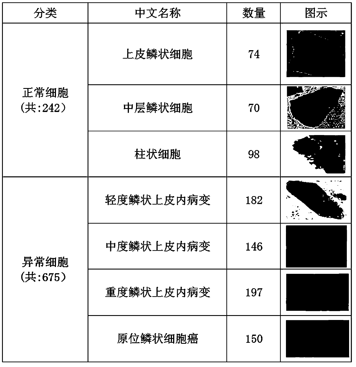 Fuzzy integration multiple classifier integration-based uterine neck cell image identification method and device