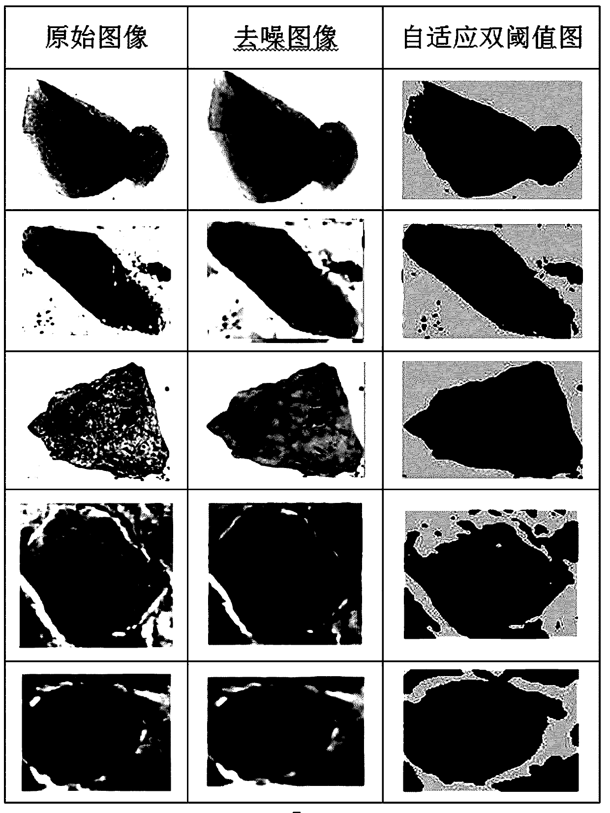 Fuzzy integration multiple classifier integration-based uterine neck cell image identification method and device