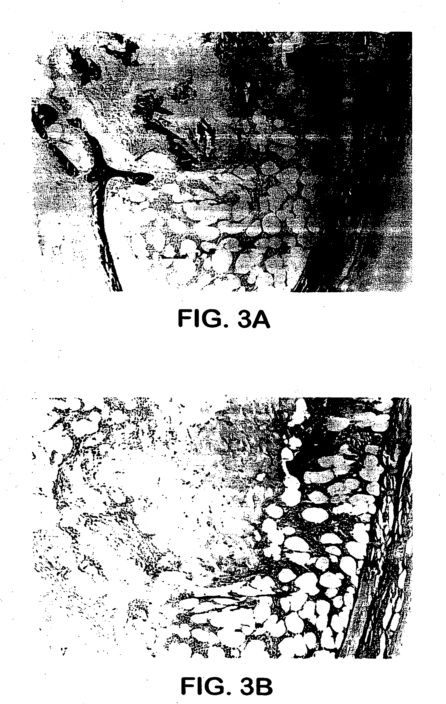 Cartilage/bone inducing materials for preparation