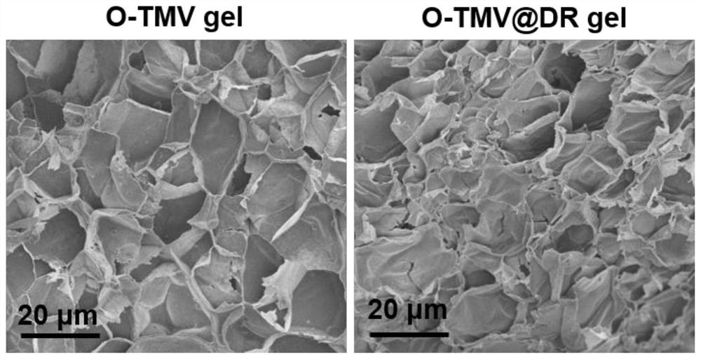 A kind of bioactive preparation based on tumor cell membrane and its preparation method and application