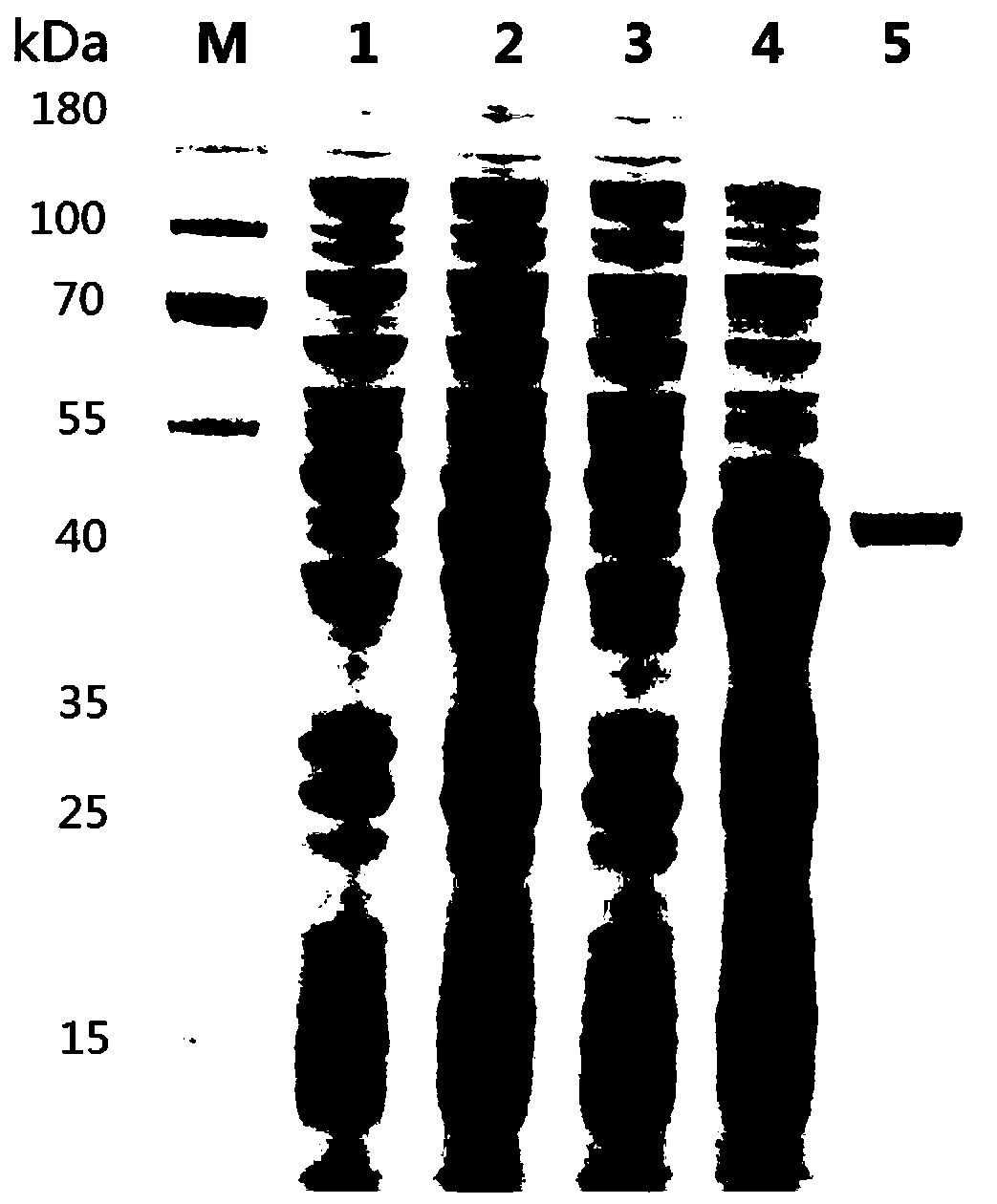 Schistosoma haematobium recombinant fusion protein ShSAP and application of schistosoma haematobium recombinant fusion protein ShSAP in immunodiagnosis of schistosomiasis