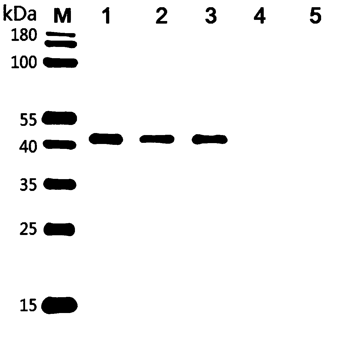 Schistosoma haematobium recombinant fusion protein ShSAP and application of schistosoma haematobium recombinant fusion protein ShSAP in immunodiagnosis of schistosomiasis