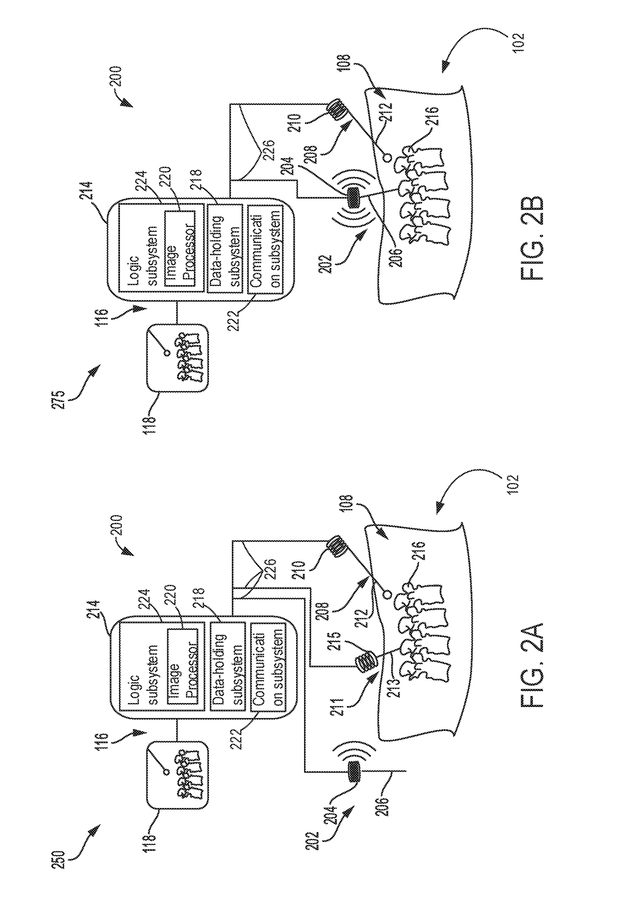 Medical tracking sensor assembly