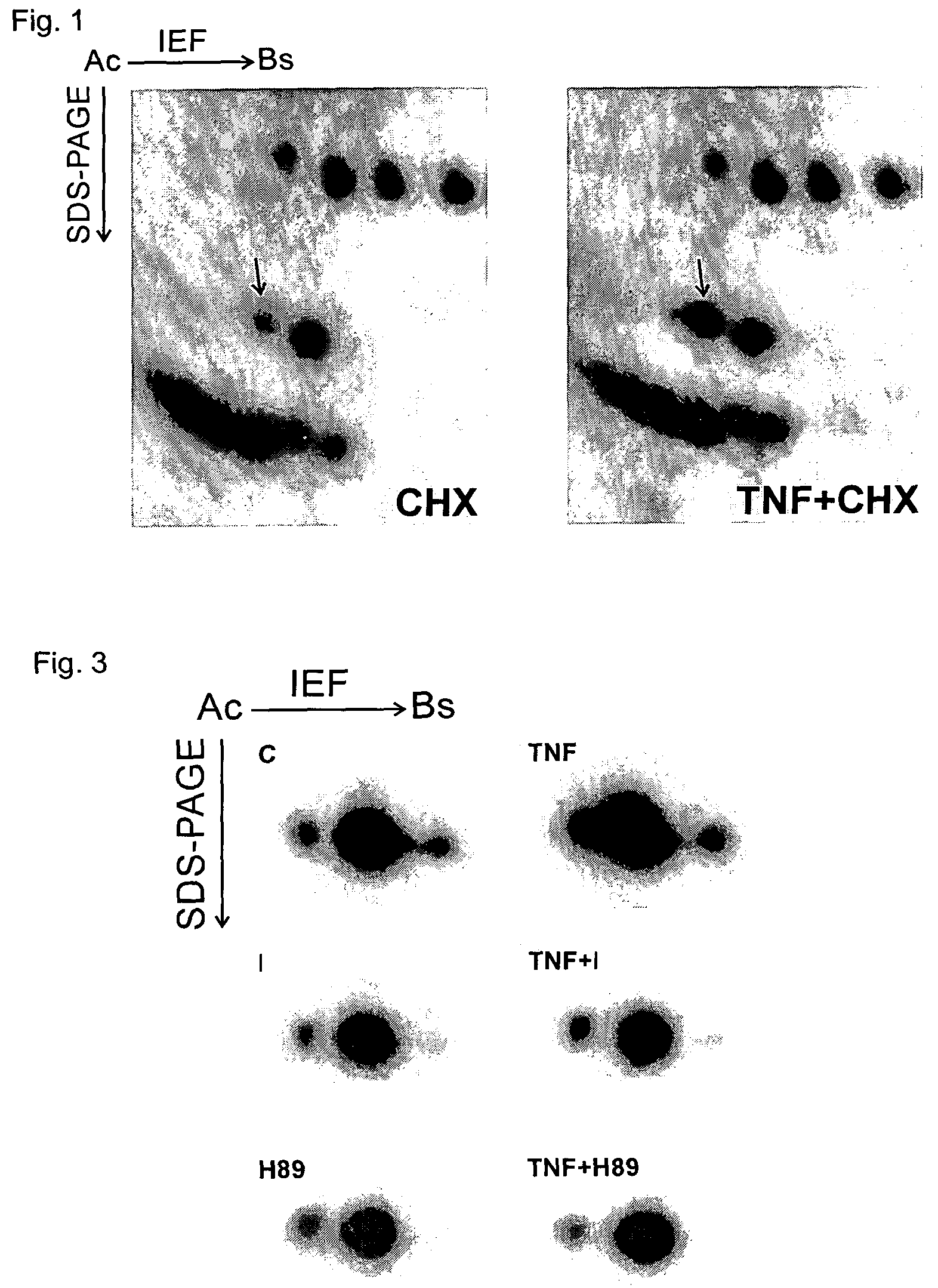 Phosphorylated glyoxalase I and its use