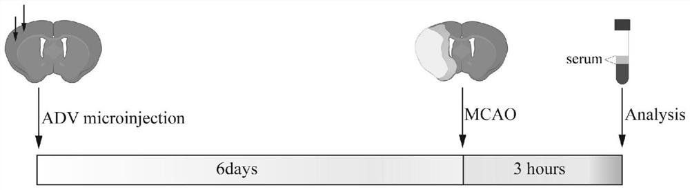 Application of plasma exosome CircOGDH as diagnostic biomarker of acute ischemic stroke