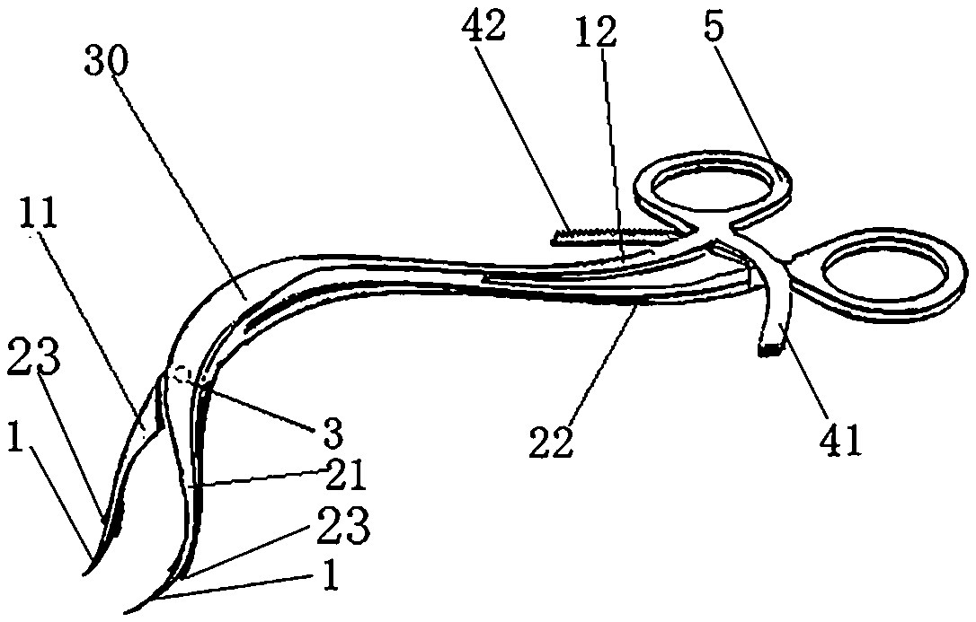 Operating forceps used for mandibular angle fracture reduction