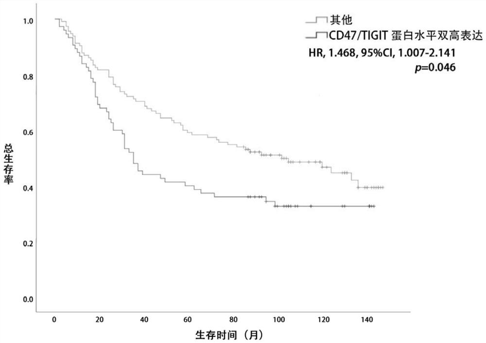 CD47 and TIGIT double-target-point-based lung squamous cell carcinoma patient prognosis evaluation system and application thereof