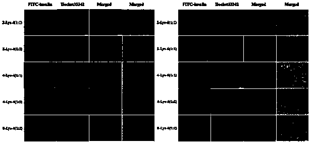 Lysine-based polyesteramide nano drug delivery system as well as preparation method and application thereof