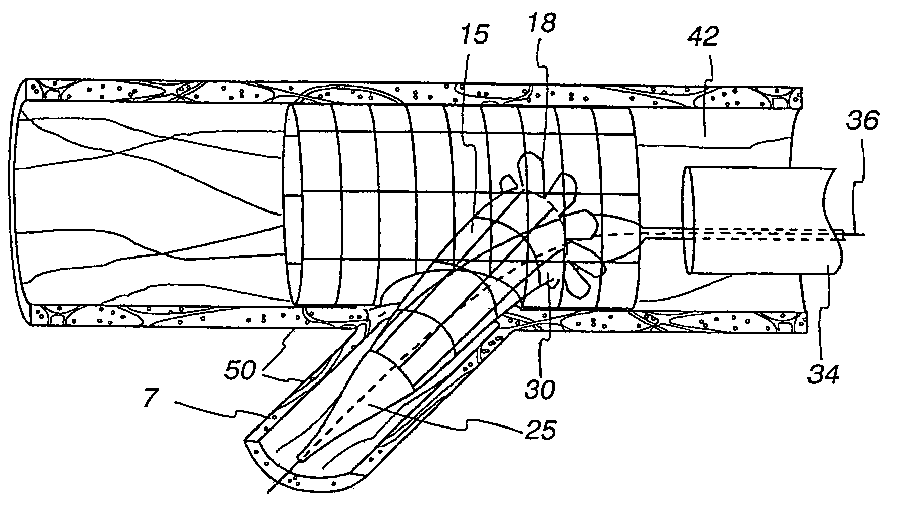 Extendible stent apparatus