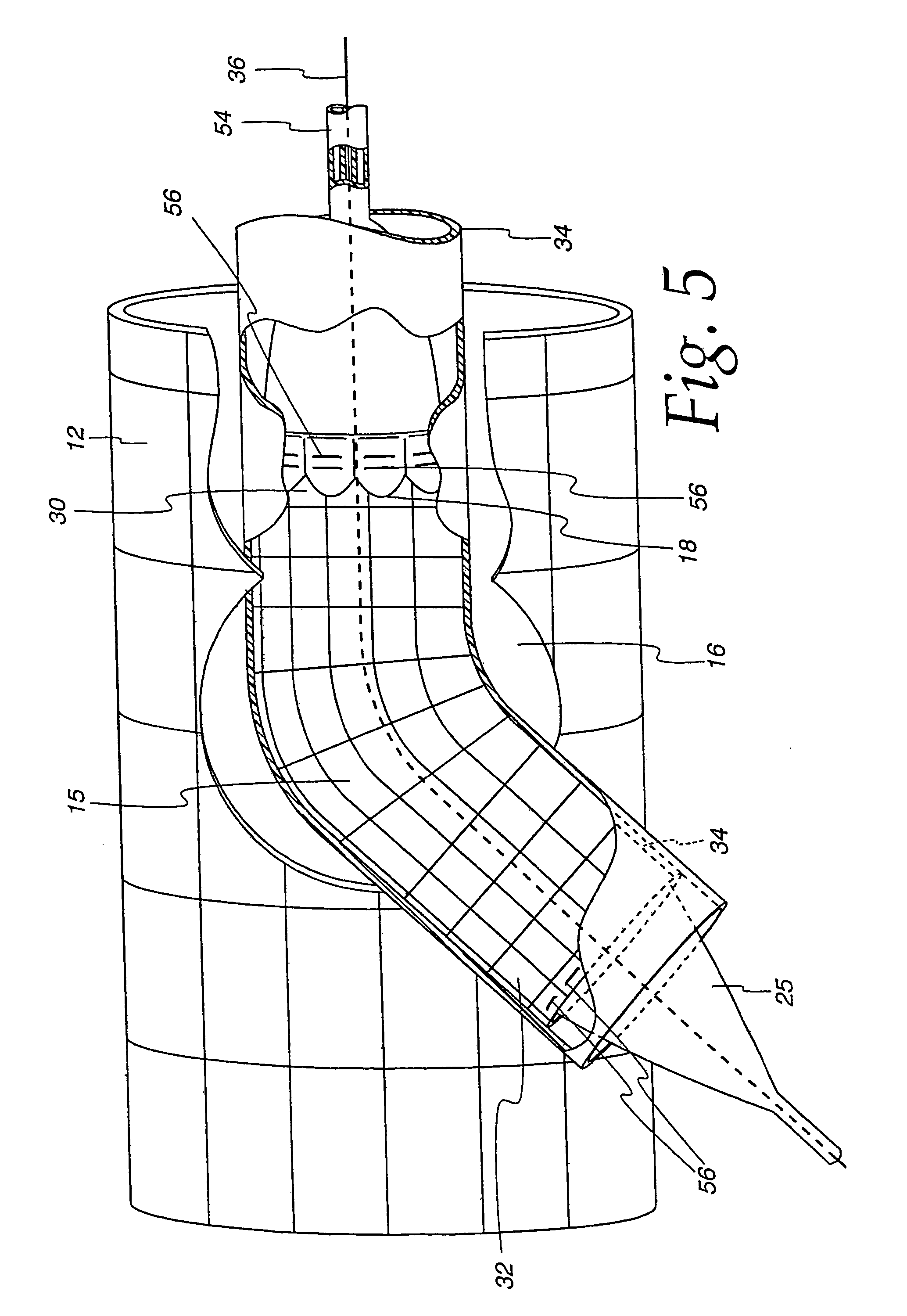 Extendible stent apparatus