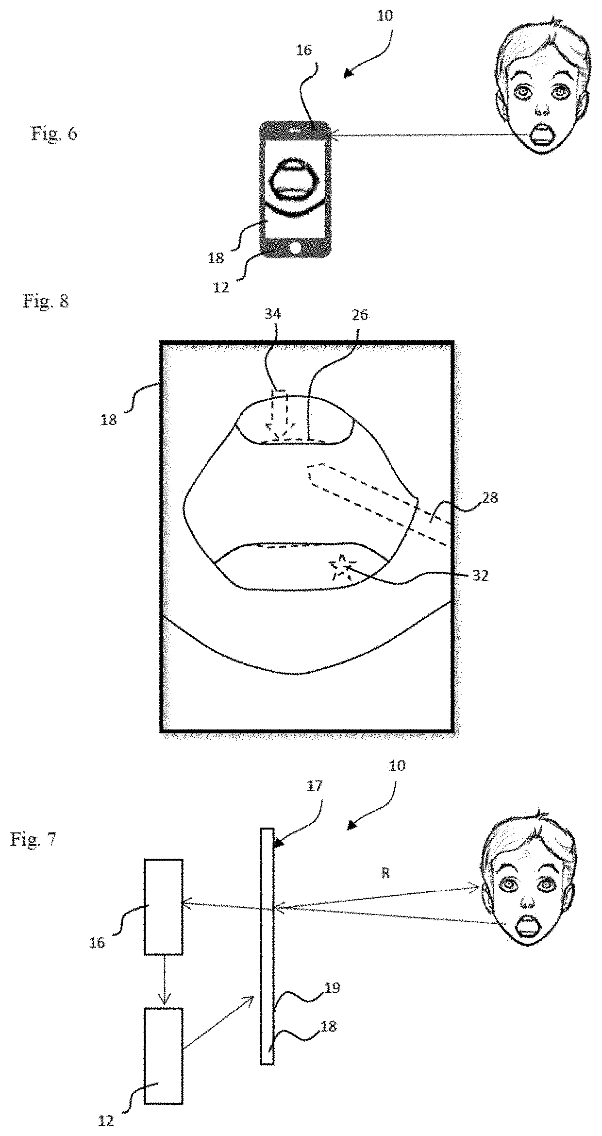 Method for analysing a dental situation