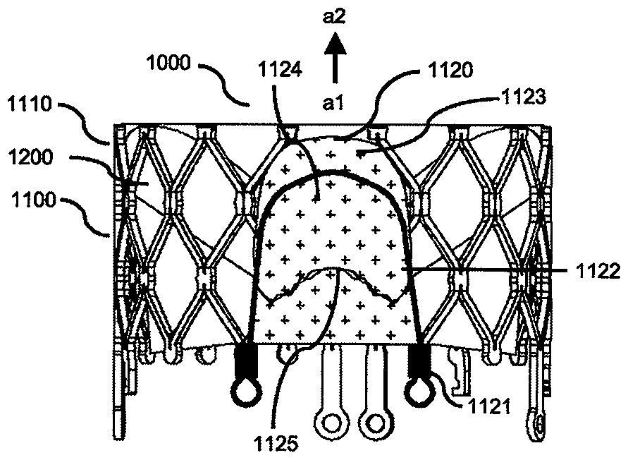 Prosthetic valve prosthesis