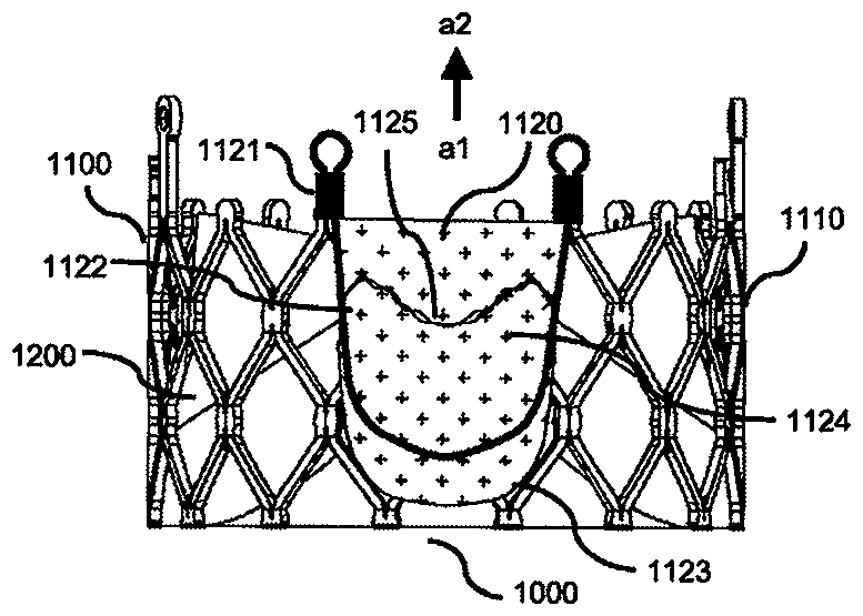 Prosthetic valve prosthesis