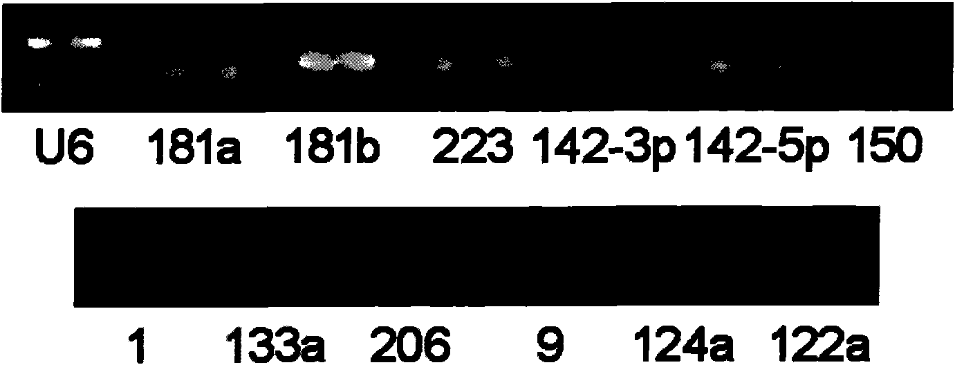 Pancreatic cancer marker, and detection method, kit and biochip thereof