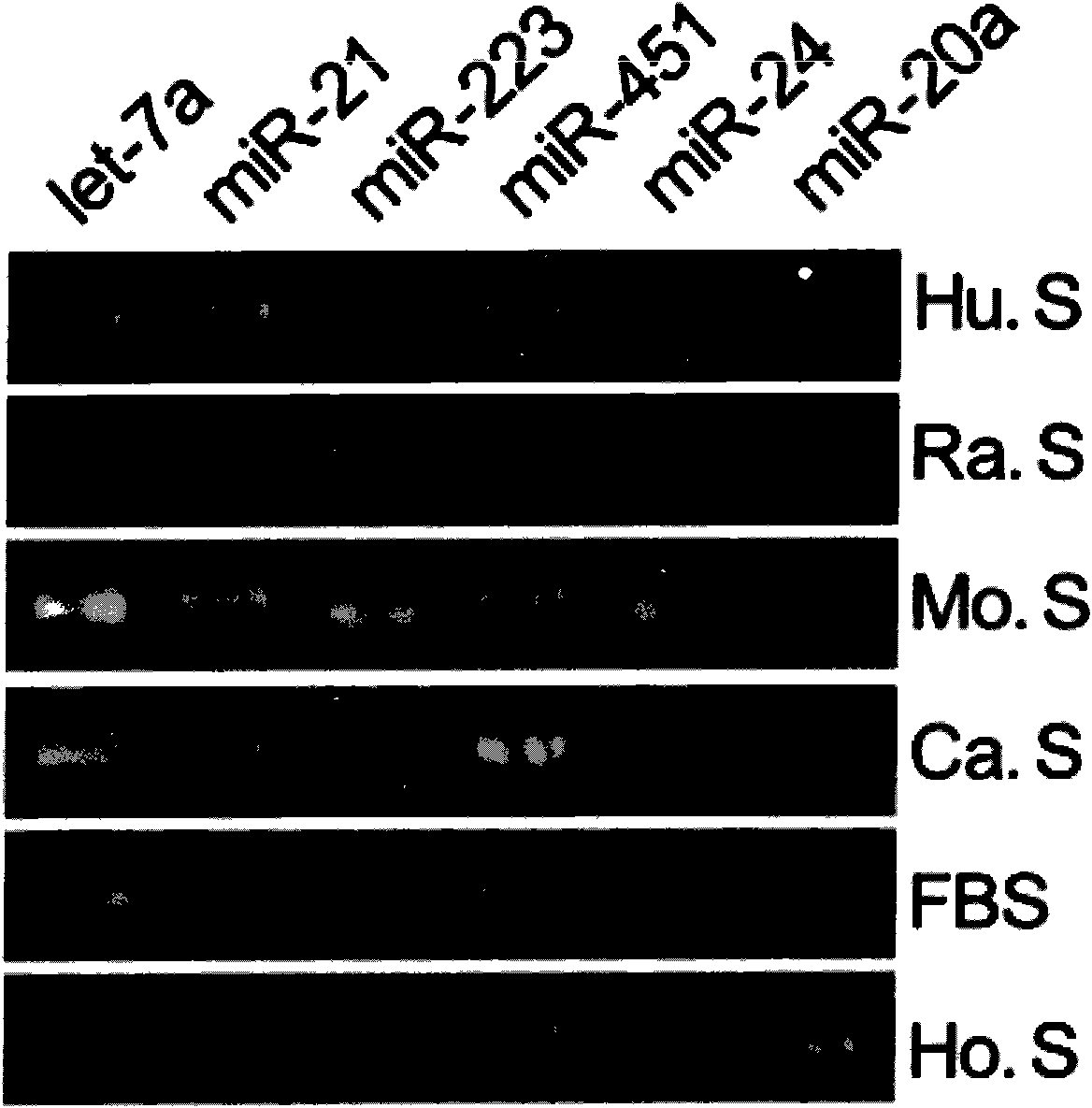 Pancreatic cancer marker, and detection method, kit and biochip thereof